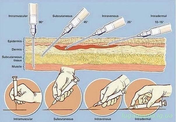 Под каким углом делать инъекции?